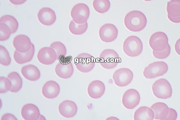 Hématies humaines avec plaquettes sanguines x640 - gryphea.org